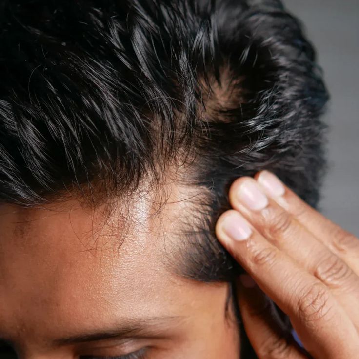 5 Potencias-Serum Anticaída